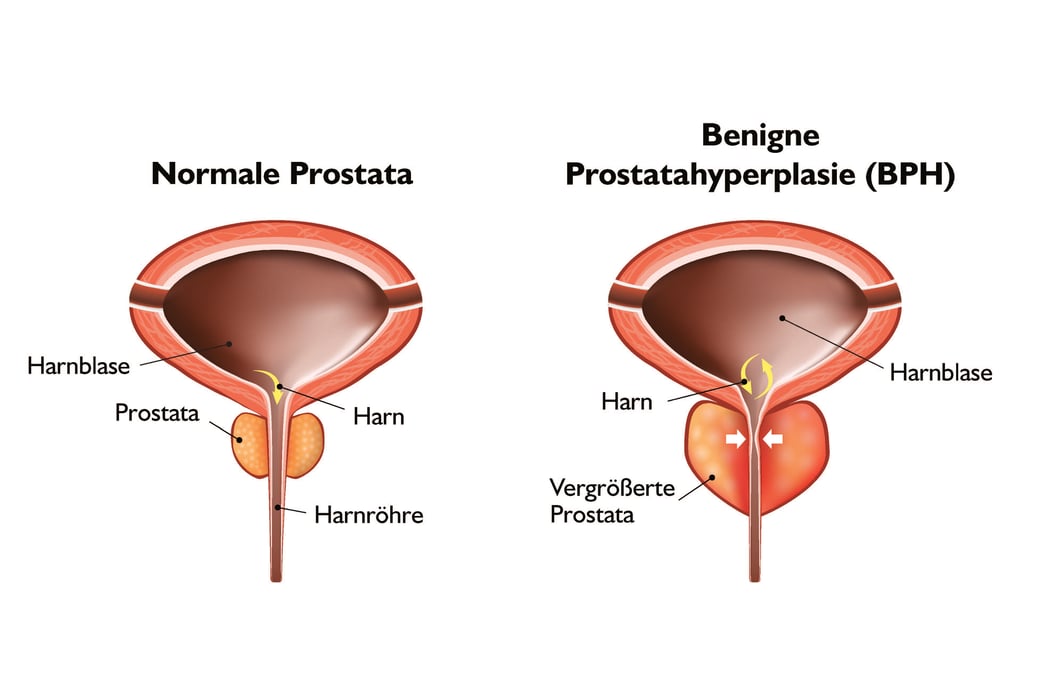 Prostate image - DE website