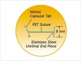 UroLift-Implantat-Diagramm